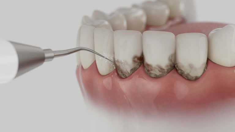 Reliable Dental contractor in Dublin, OH by Dentist Open Now
